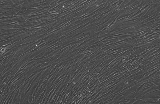Phase-contrast micrograph of fibroblasts at day 1: aligned, spindle-shaped cells in a smooth parallel sheet.