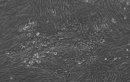 Phase-contrast micrograph at day 10 after reprogramming with wild-type SOX2, KLF4, OCT4 and MYC: a few small, bright colonies scattered across the fibroblast sheet.