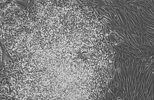Phase-contrast micrograph at day 10 after reprogramming with RetroSOX, RetroKLF, OCT4 and MYC: most of the field densely covered in bright reprogrammed colonies.